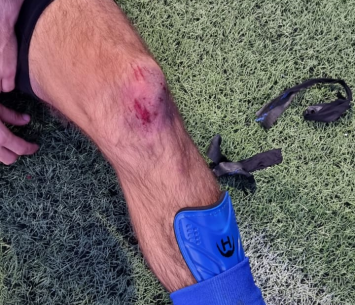 רגלו של אחד משחקני גני תקווה