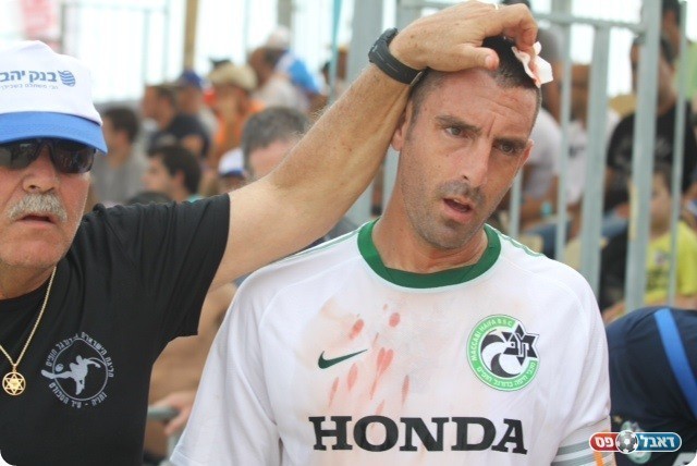 נפגע ונזקק לתפרים בראשו.אילן סויסה